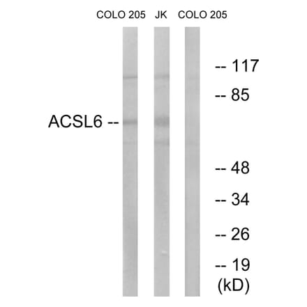 Western Blot - Anti-ACSL6 Antibody (C16495) - Antibodies.com