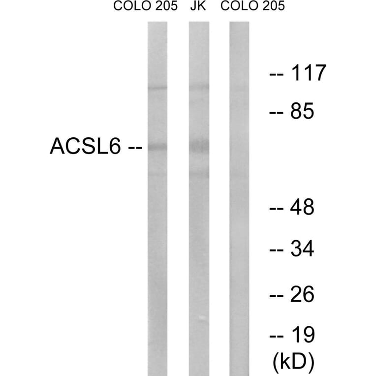 Western Blot - Anti-ACSL6 Antibody (C16495) - Antibodies.com
