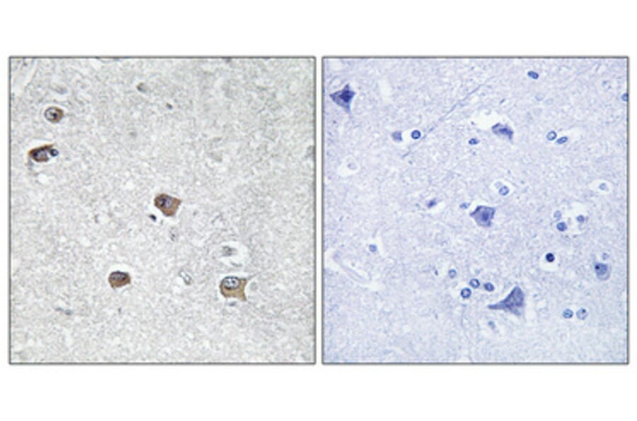 Immunohistochemistry - Anti-ACSL6 Antibody (C16495) - Antibodies.com