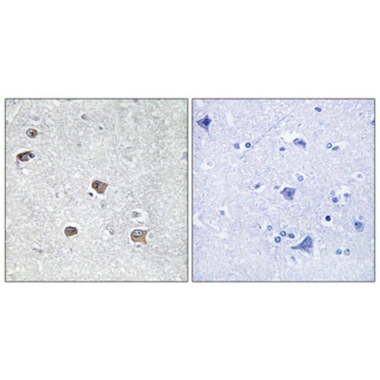 Immunohistochemistry - Anti-ACSL6 Antibody (C16495) - Antibodies.com