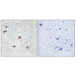 Immunohistochemistry - Anti-ACSL6 Antibody (C16495) - Antibodies.com