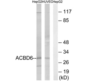 Western Blot - Anti-ACBD6 Antibody (C14262) - Antibodies.com