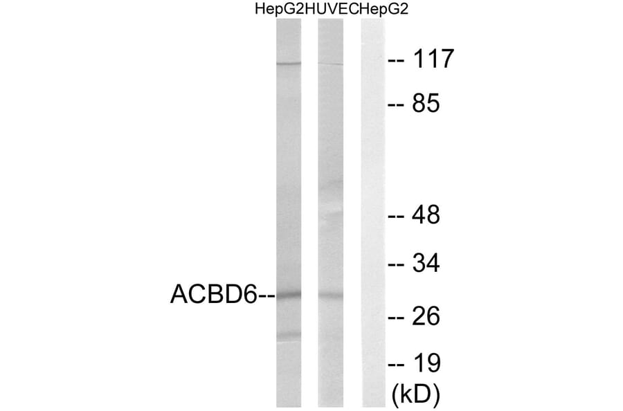 Western Blot - Anti-ACBD6 Antibody (C14262) - Antibodies.com
