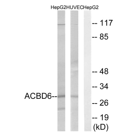 Western Blot - Anti-ACBD6 Antibody (C14262) - Antibodies.com