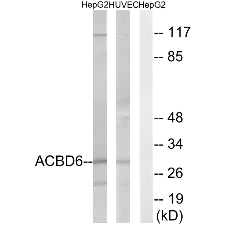 Western Blot - Anti-ACBD6 Antibody (C14262) - Antibodies.com