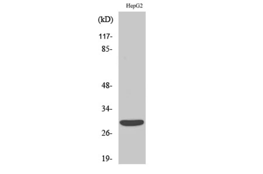 Western Blot - Anti-ACBD6 Antibody (C14262) - Antibodies.com