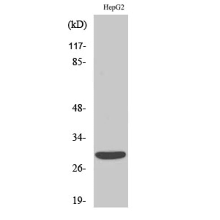 Western Blot - Anti-ACBD6 Antibody (C14262) - Antibodies.com