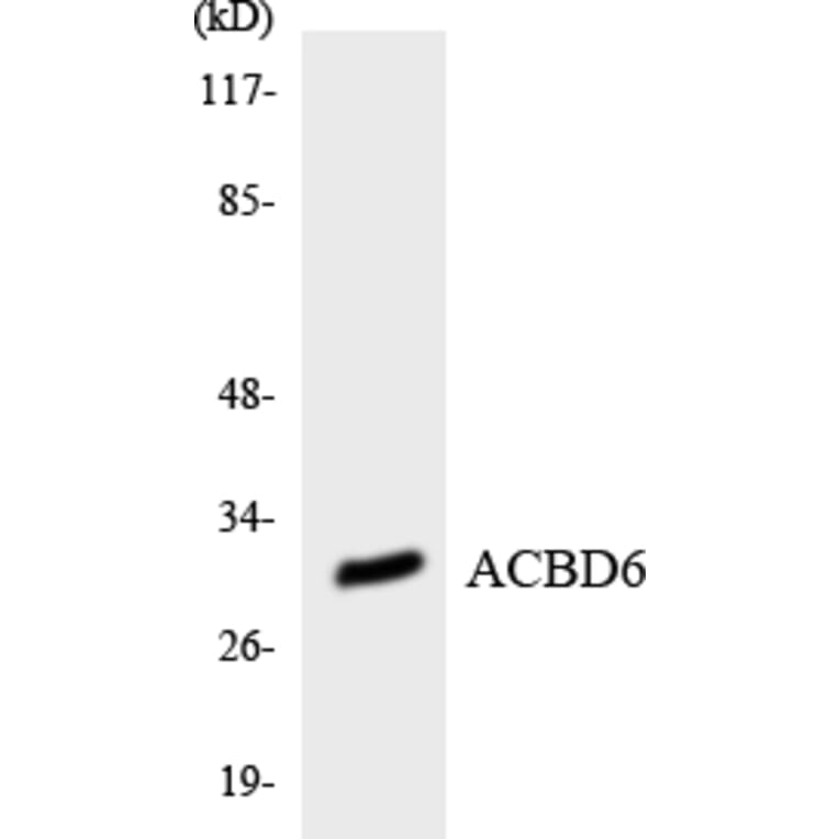 Western Blot - Anti-ACBD6 Antibody (R12-2434) - Antibodies.com