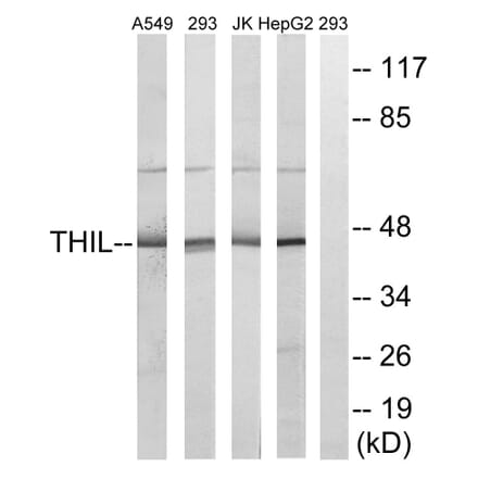 Western Blot - Anti-ACAT1 Antibody (C14232) - Antibodies.com