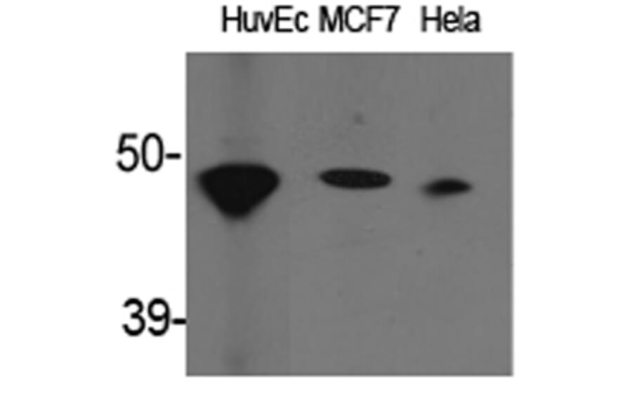 Western Blot - Anti-ACAT1 Antibody (C14232) - Antibodies.com