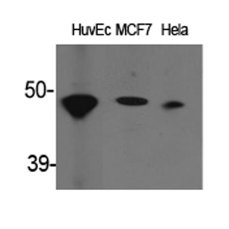 Western Blot - Anti-ACAT1 Antibody (C14232) - Antibodies.com