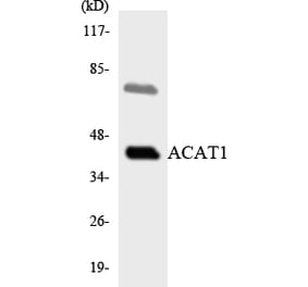 Western Blot - Anti-ACAT1 Antibody (R12-2433) - Antibodies.com