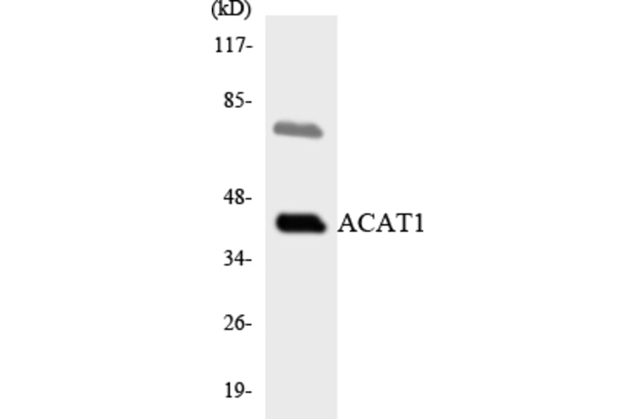 Western Blot - Anti-ACAT1 Antibody (R12-2433) - Antibodies.com