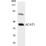 Western Blot - Anti-ACAT1 Antibody (R12-2433) - Antibodies.com