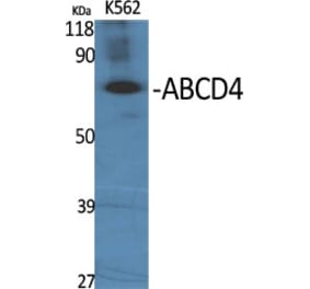 Western Blot - Anti-ABCD4 Antibody (C14627) - Antibodies.com