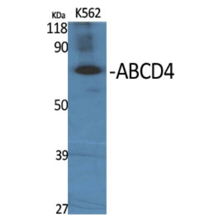 Western Blot - Anti-ABCD4 Antibody (C14627) - Antibodies.com