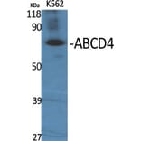 Western Blot - Anti-ABCD4 Antibody (C14627) - Antibodies.com