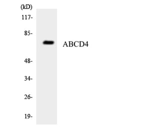 Western Blot - Anti-ABCD4 Antibody (R12-2428) - Antibodies.com
