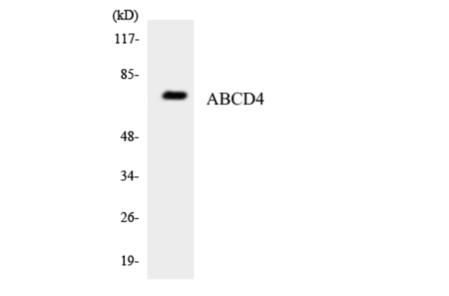 Western Blot - Anti-ABCD4 Antibody (R12-2428) - Antibodies.com