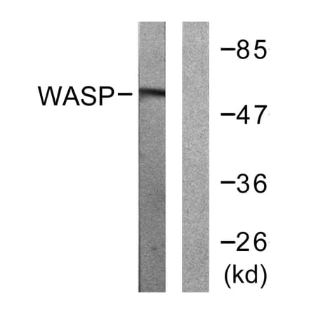 Western Blot - Anti-WASP Antibody (B0597) - Antibodies.com