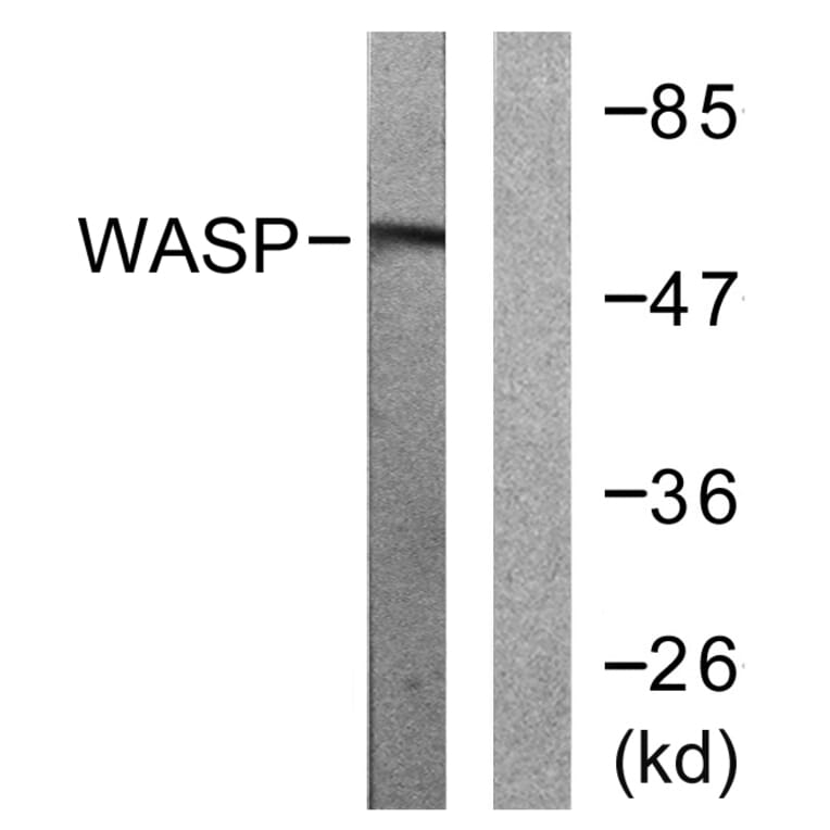 Western Blot - Anti-WASP Antibody (B0597) - Antibodies.com