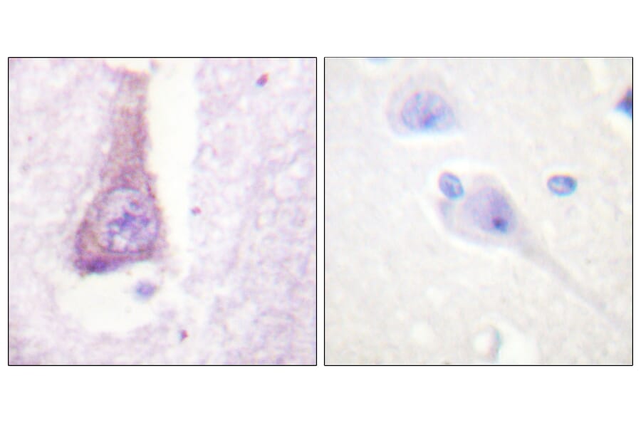 Immunohistochemistry - Anti-WASP Antibody (B0597) - Antibodies.com