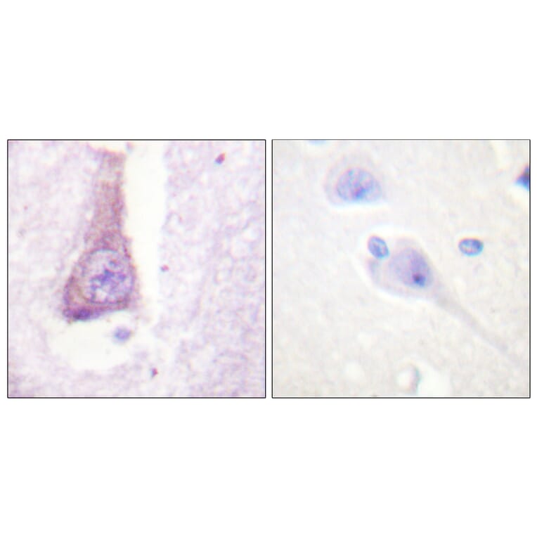Immunohistochemistry - Anti-WASP Antibody (B0597) - Antibodies.com
