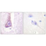Immunohistochemistry - Anti-WASP Antibody (B0597) - Antibodies.com
