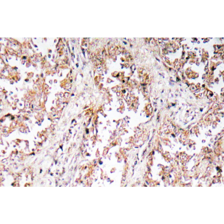Immunohistochemistry - Anti-UCP2 Antibody (R12-2400) - Antibodies.com