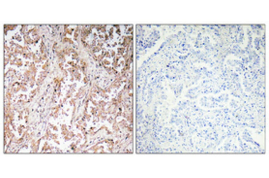 Immunohistochemistry - Anti-UCP2 Antibody (R12-2400) - Antibodies.com