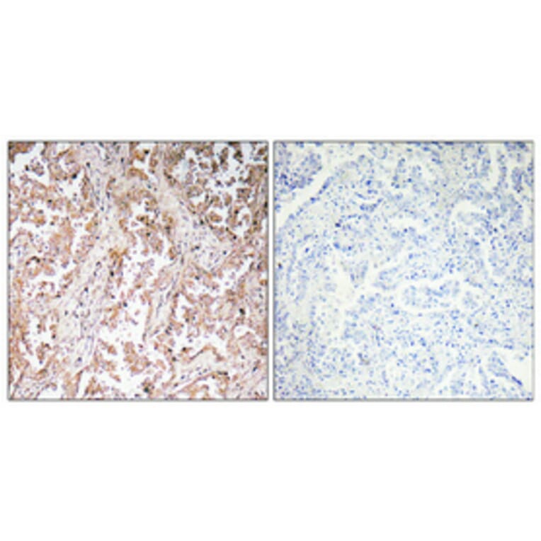 Immunohistochemistry - Anti-UCP2 Antibody (R12-2400) - Antibodies.com