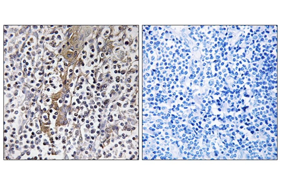 Immunohistochemistry - Anti-TMC8 Antibody (C19284) - Antibodies.com