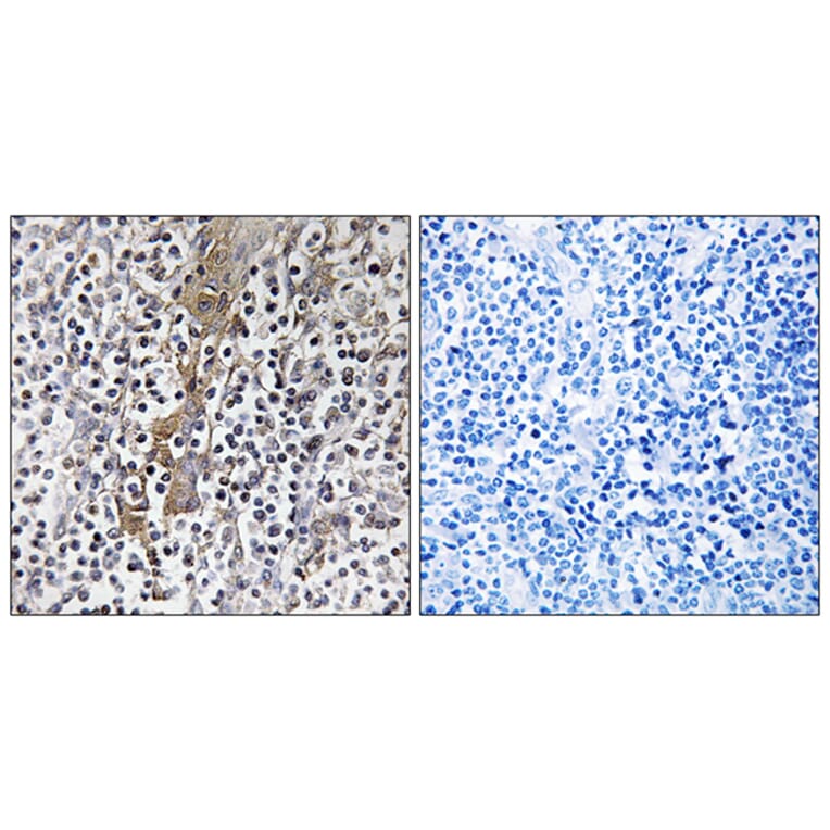 Immunohistochemistry - Anti-TMC8 Antibody (C19284) - Antibodies.com