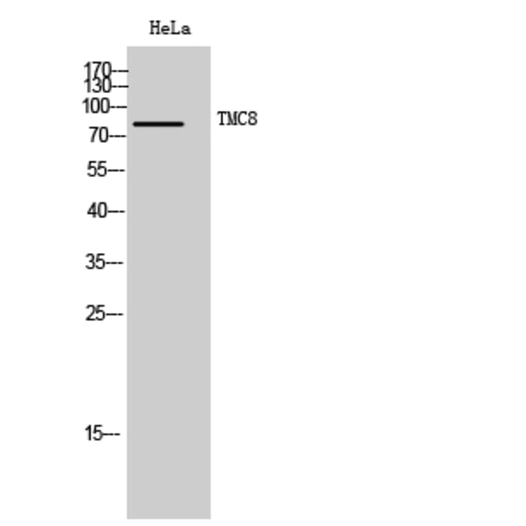 Western Blot - Anti-TMC8 Antibody (C19284) - Antibodies.com