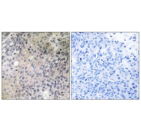 Immunohistochemistry - Anti-SHC3 Antibody (C18734) - Antibodies.com