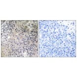 Immunohistochemistry - Anti-SHC3 Antibody (C18734) - Antibodies.com