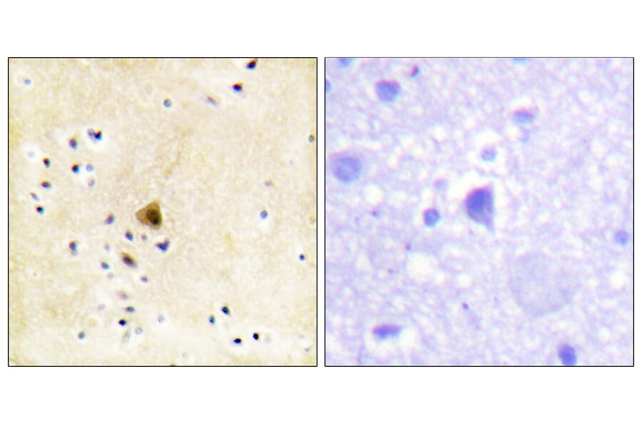 Immunohistochemistry - Anti-RyR2 Antibody (B0570) - Antibodies.com