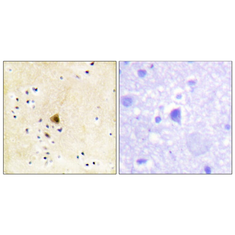 Immunohistochemistry - Anti-RyR2 Antibody (B0570) - Antibodies.com