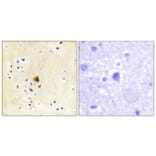 Immunohistochemistry - Anti-RyR2 Antibody (B0570) - Antibodies.com