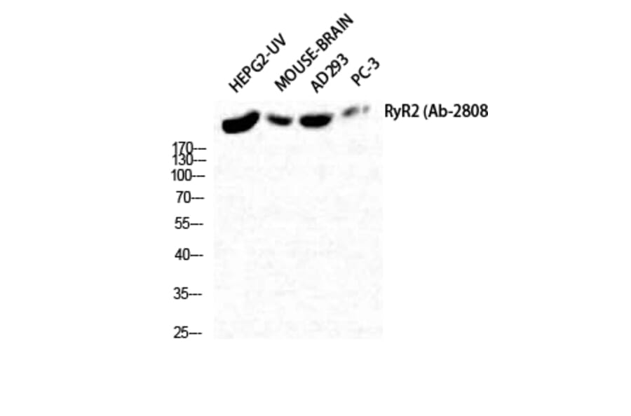 Western Blot - Anti-RyR2 Antibody (B0570) - Antibodies.com