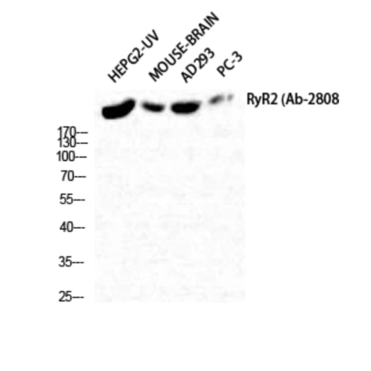 Western Blot - Anti-RyR2 Antibody (B0570) - Antibodies.com