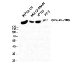 Western Blot - Anti-RyR2 Antibody (B0570) - Antibodies.com
