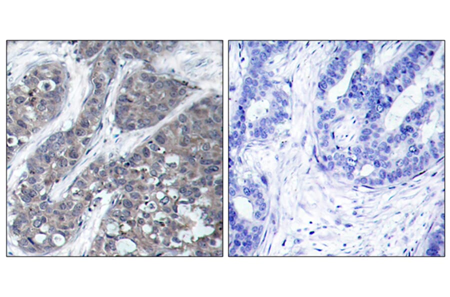 Immunohistochemistry - Anti-PYK2 Antibody (B7204) - Antibodies.com