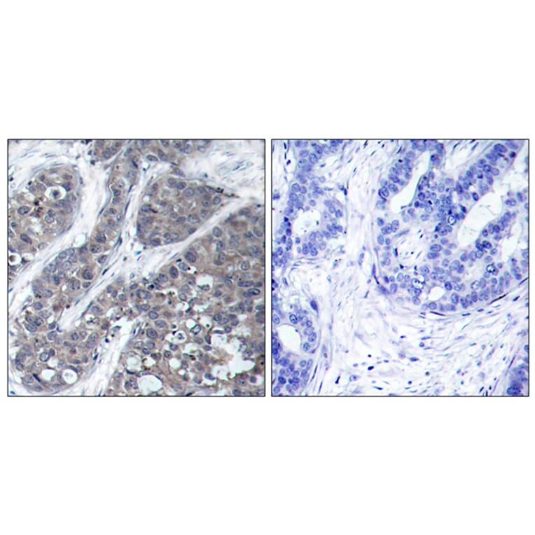 Immunohistochemistry - Anti-PYK2 Antibody (B7204) - Antibodies.com