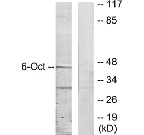Western Blot - Anti-OCT6 Antibody (C10863) - Antibodies.com