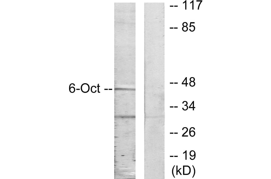 Western Blot - Anti-OCT6 Antibody (C10863) - Antibodies.com