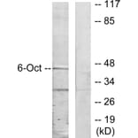 Western Blot - Anti-OCT6 Antibody (C10863) - Antibodies.com