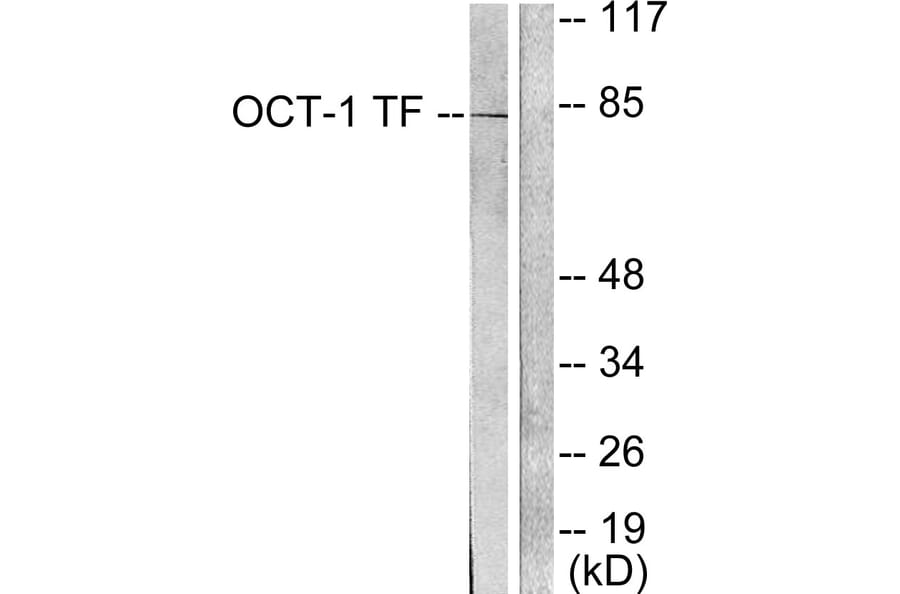 Western Blot - Anti-OCT1 Antibody (C0281) - Antibodies.com