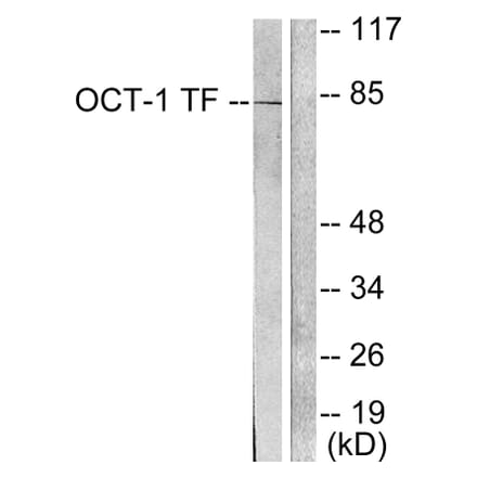 Western Blot - Anti-OCT1 Antibody (C0281) - Antibodies.com