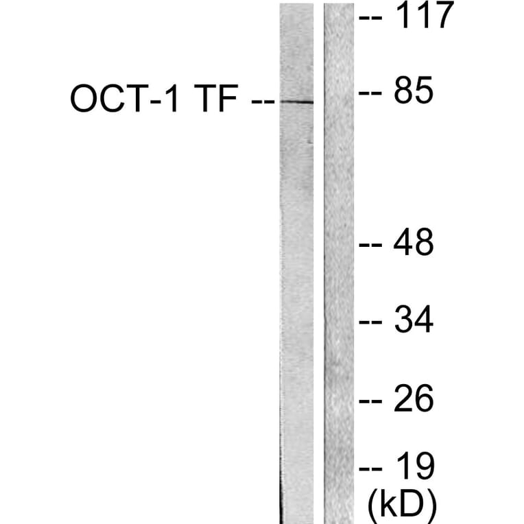Western Blot - Anti-OCT1 Antibody (C0281) - Antibodies.com